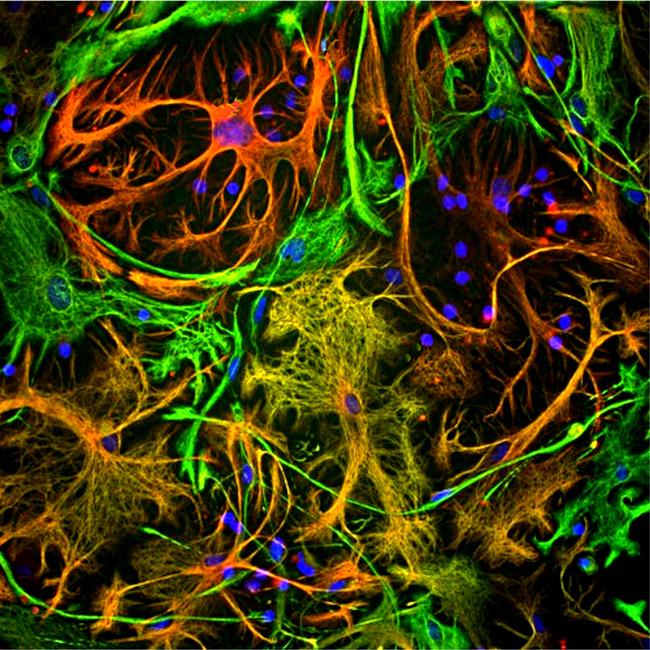 Vimentin Antibody in Immunocytochemistry (ICC/IF)