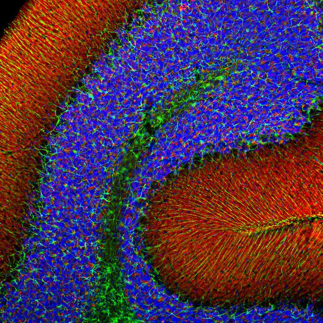 alpha Synuclein Antibody in Immunohistochemistry (PFA fixed) (IHC (PFA))