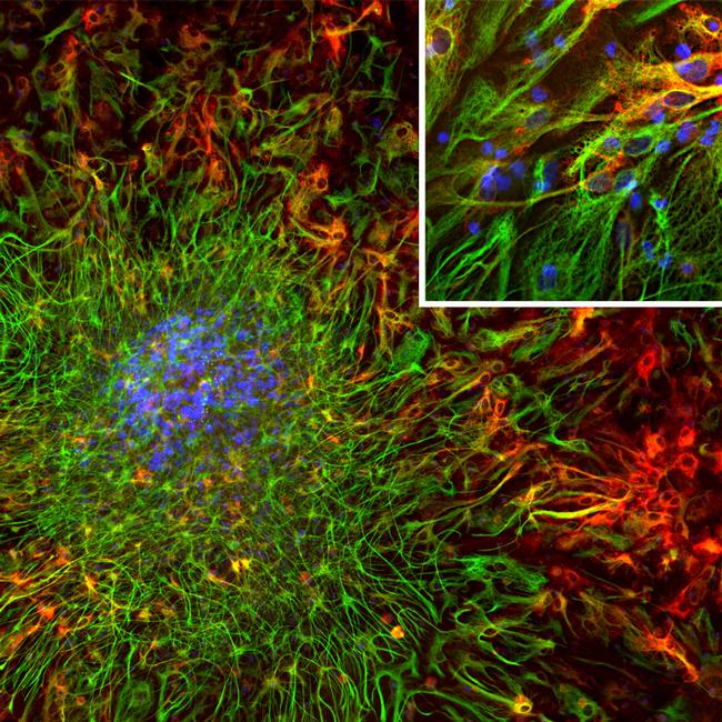 ALDH1L1 Antibody in Immunocytochemistry (ICC/IF)