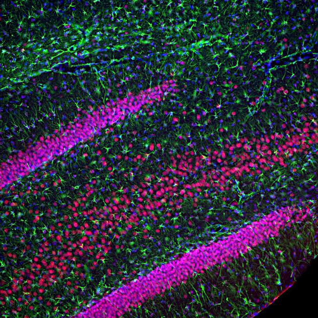 TDP-43 Antibody in Immunohistochemistry (PFA fixed) (IHC (PFA))