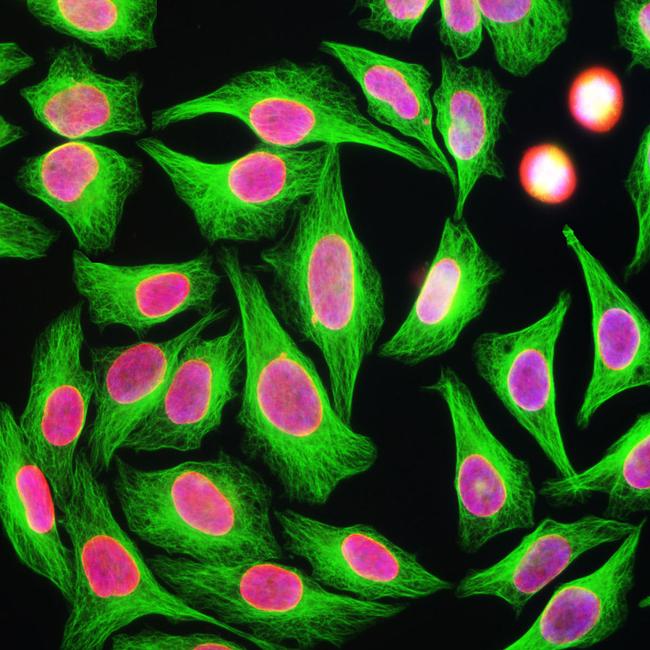 beta Tubulin Antibody in Immunocytochemistry (ICC/IF)