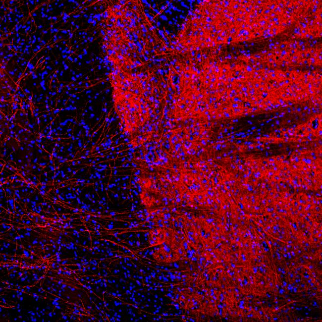 Tyrosine Hydroxylase Antibody in Immunohistochemistry (PFA fixed) (IHC (PFA))