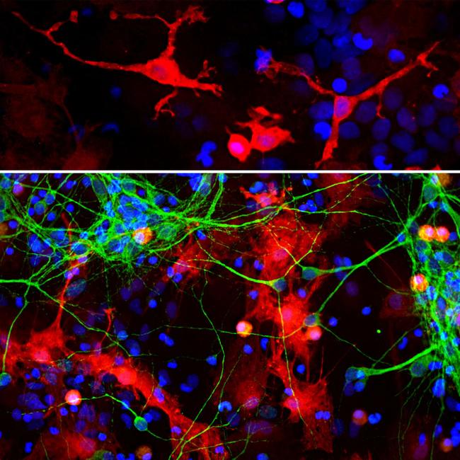 Galectin 3 Antibody in Immunocytochemistry (ICC/IF)