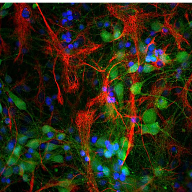 PGP9.5 Antibody in Immunocytochemistry (ICC/IF)