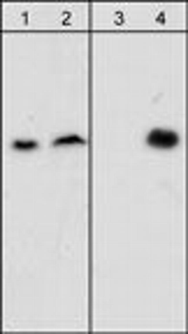 Phospho-beta Dystroglycan (Tyr892) Antibody in Western Blot (WB)