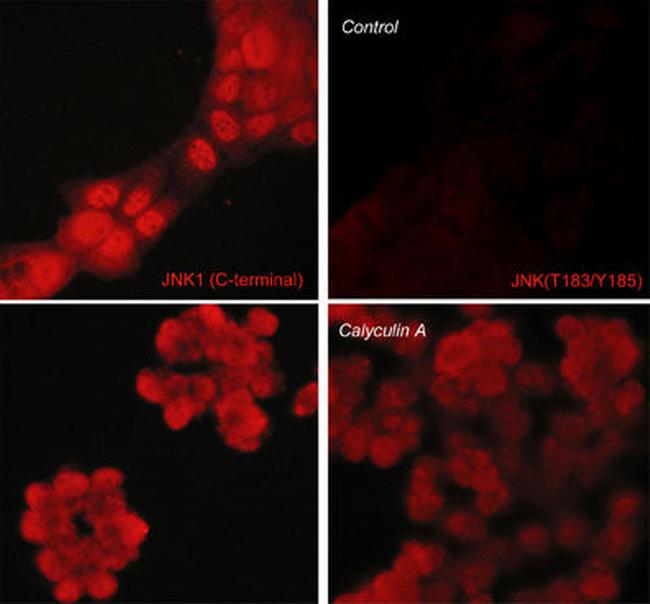 Phospho-JNK1 (Thr183, Tyr185) Antibody in Immunocytochemistry (ICC/IF)