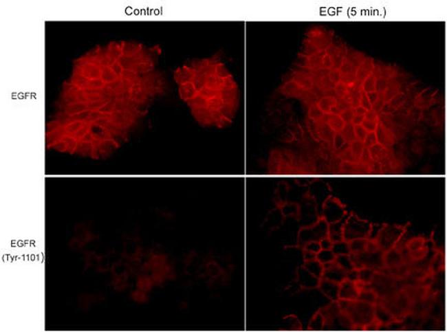 Phospho-EGFR (Tyr1101) Antibody in Immunocytochemistry (ICC/IF)