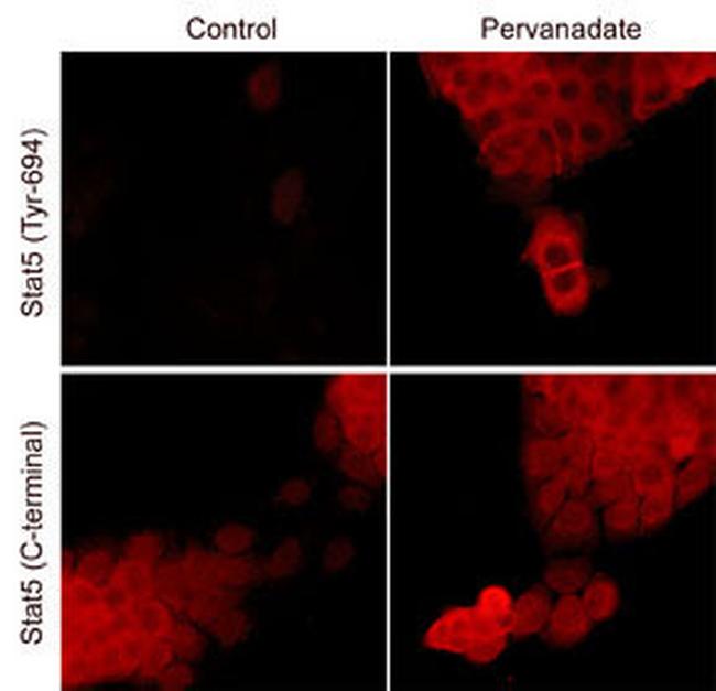 Phospho-STAT5 (Tyr694) Antibody in Immunocytochemistry (ICC/IF)