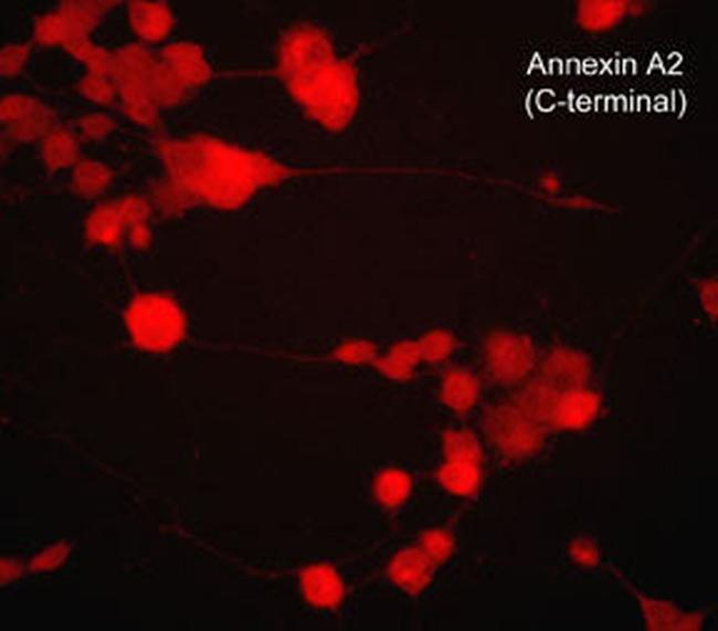 Annexin A2 Antibody in Immunocytochemistry (ICC/IF)