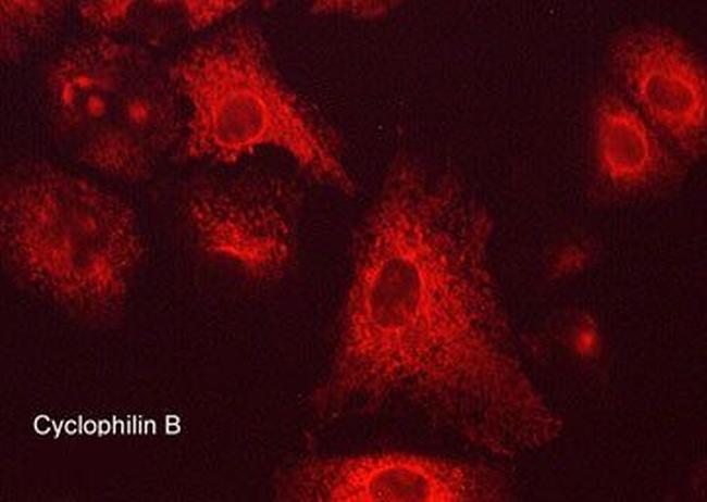 Cyclophilin B Antibody in Immunocytochemistry (ICC/IF)