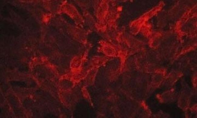 EphA2 Antibody in Immunocytochemistry (ICC/IF)