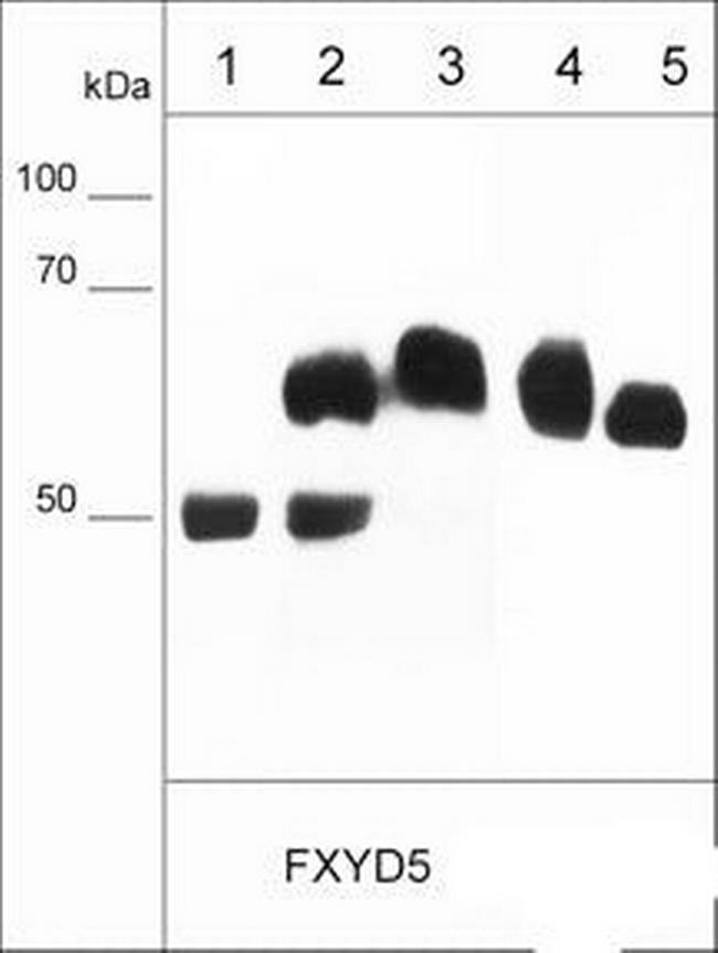 Dysadherin Antibody in Immunocytochemistry (ICC/IF)