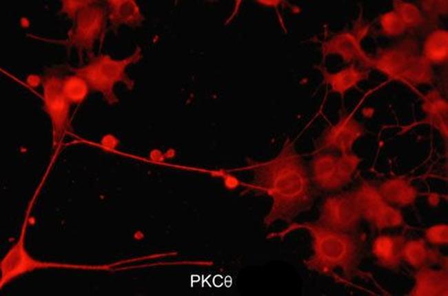 PKC theta Antibody in Immunocytochemistry (ICC/IF)