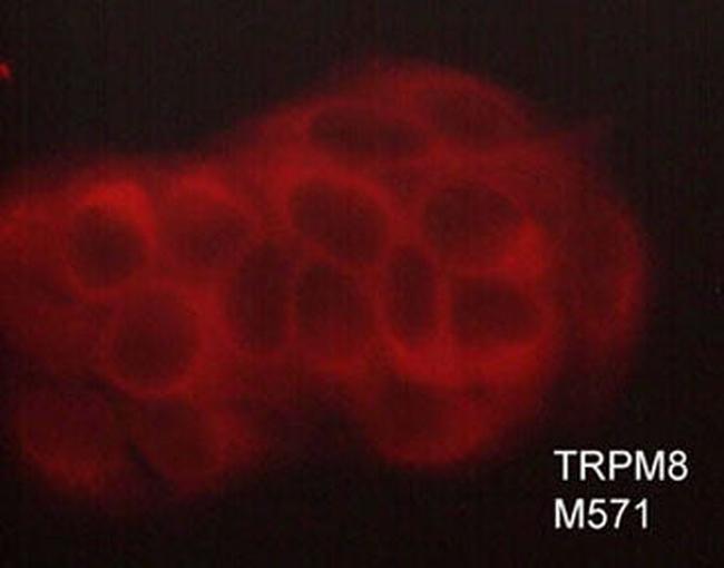 TRPM8 Antibody in Immunocytochemistry (ICC/IF)