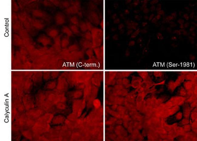 ATM Antibody in Immunocytochemistry (ICC/IF)