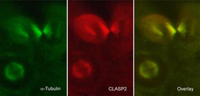 CLASP2 Antibody in Immunocytochemistry (ICC/IF)