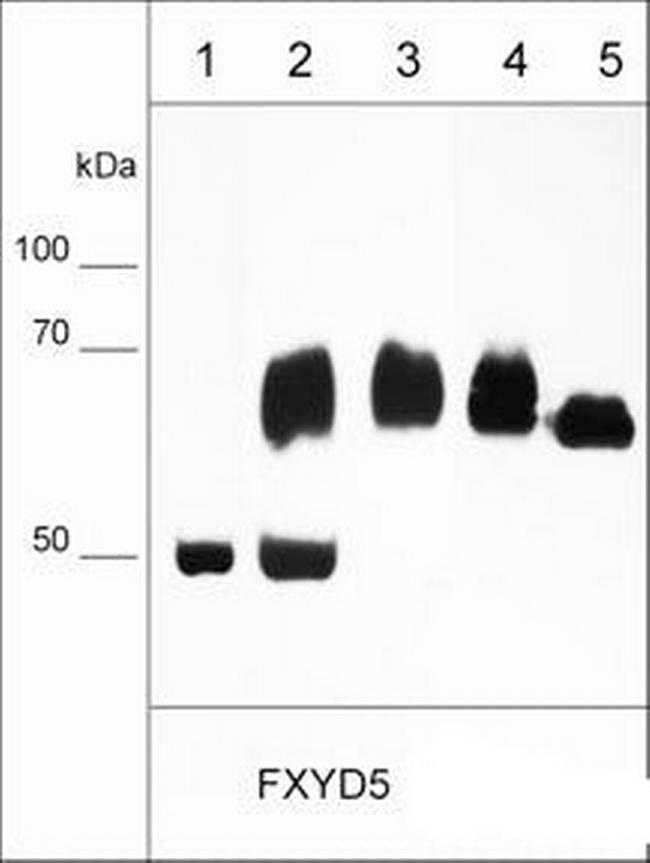 Dysadherin Antibody in Western Blot (WB)