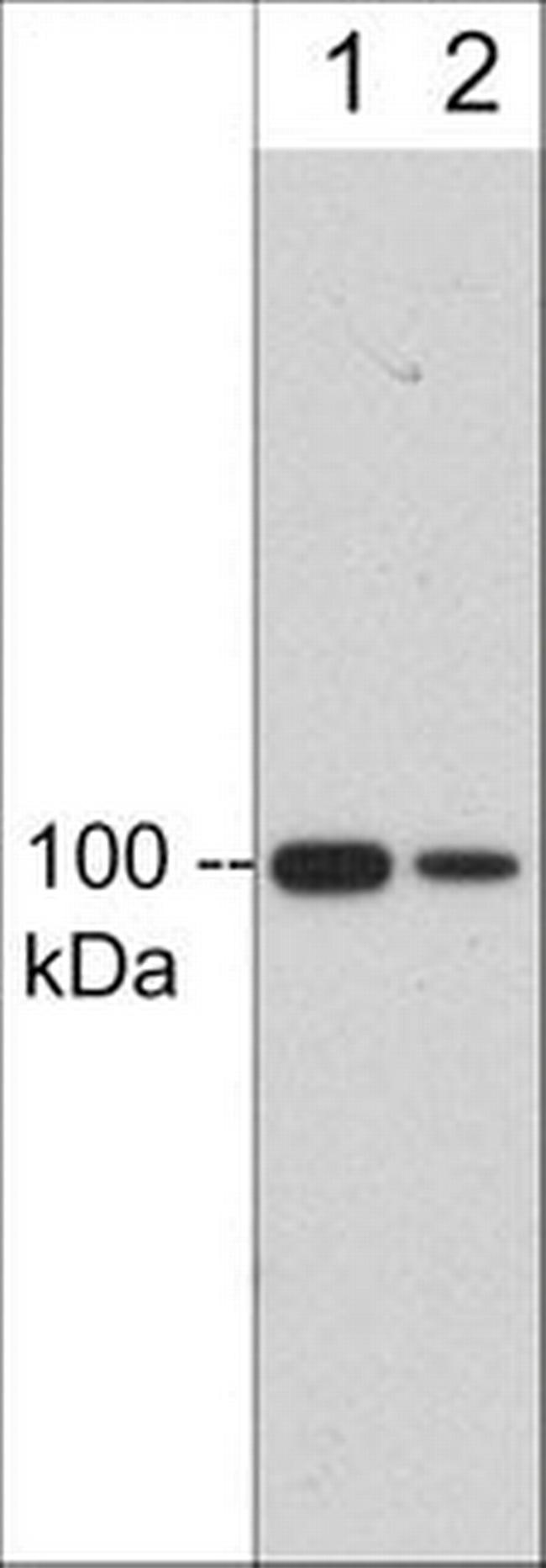 CD61 (Integrin beta 3) Antibody in Western Blot (WB)