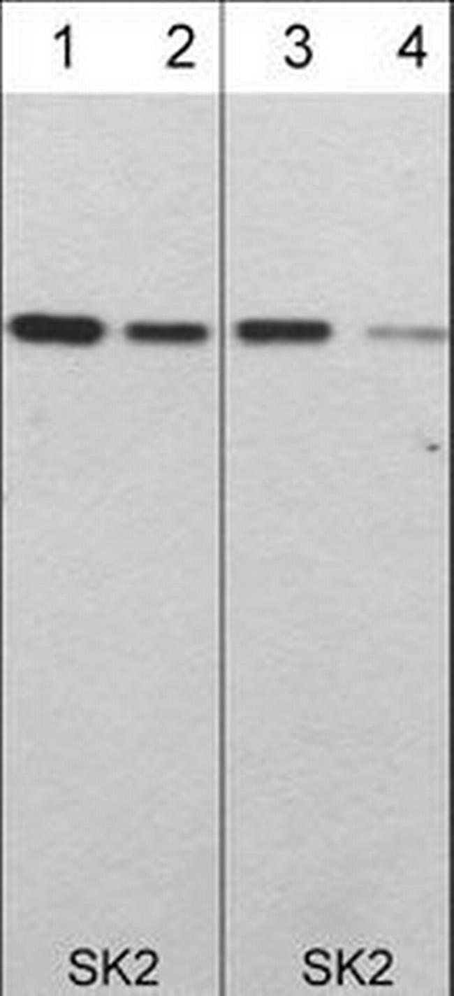 SPHK2 Antibody in Western Blot (WB)