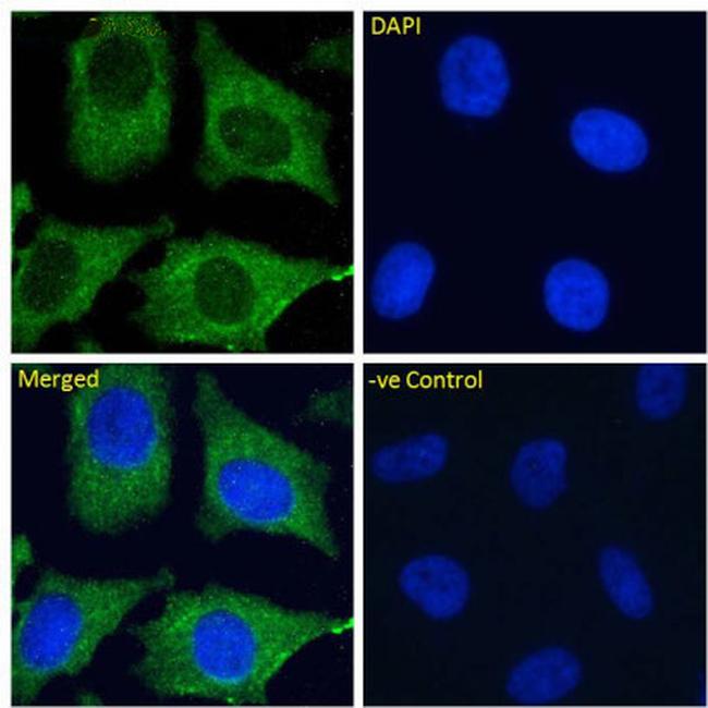 CD299 (DC-SIGN/L) Chimeric Antibody in Immunocytochemistry (ICC/IF)