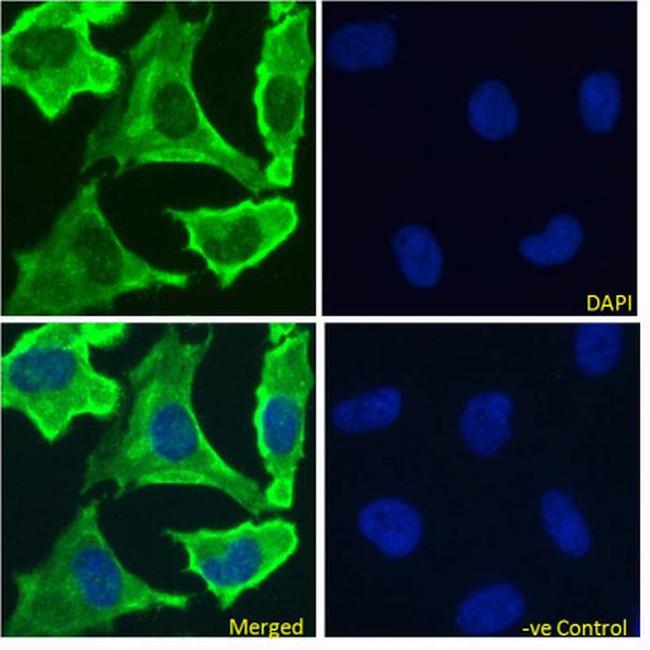 EGFR Chimeric Antibody in Immunocytochemistry (ICC/IF)