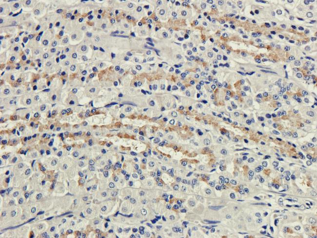 CD35 Chimeric Antibody in Immunohistochemistry (PFA fixed) (IHC (PFA))