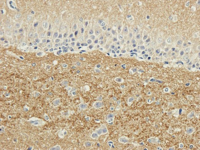 SNAP25 Antibody in Immunohistochemistry (PFA fixed) (IHC (PFA))