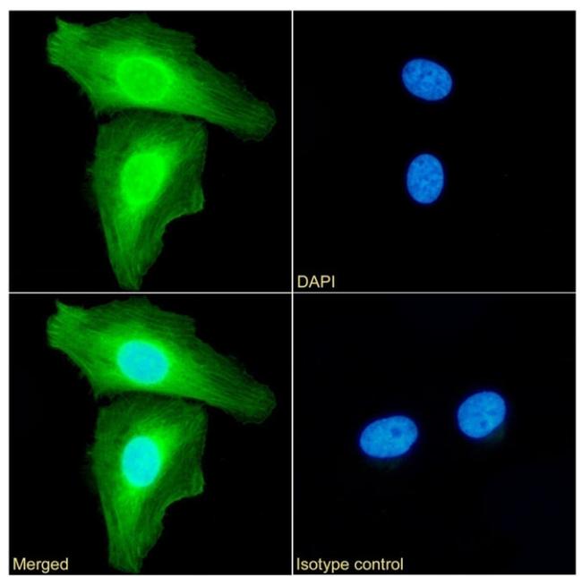 Annexin A1 Antibody in Immunocytochemistry (ICC/IF)