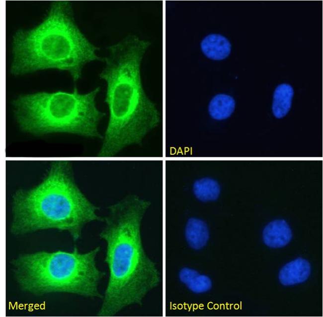 NFkB p100 Antibody in Immunocytochemistry (ICC/IF)