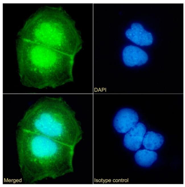 UBE2C Antibody in Immunocytochemistry (ICC/IF)