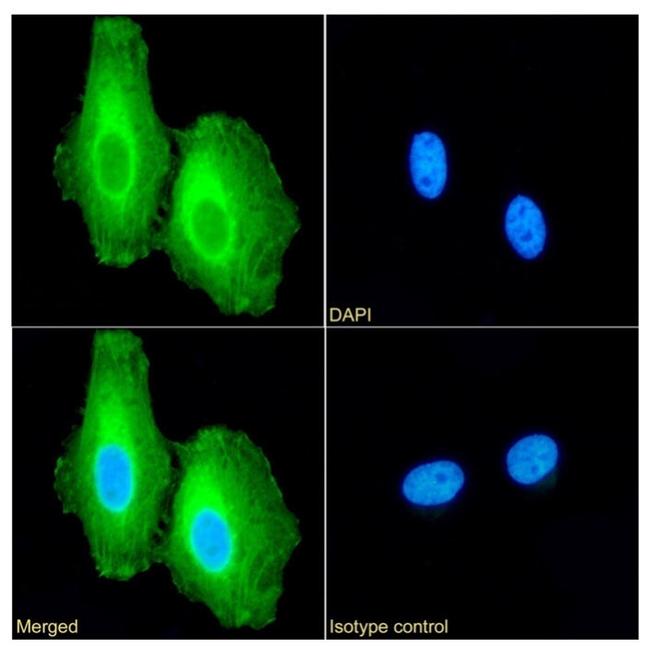 Apolipoprotein J Antibody in Immunocytochemistry (ICC/IF)