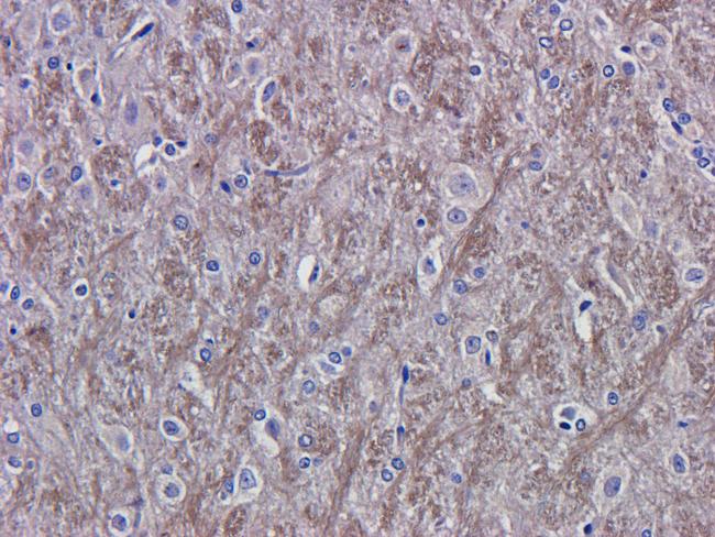 VEGF Antibody in Immunohistochemistry (Paraffin) (IHC (P))