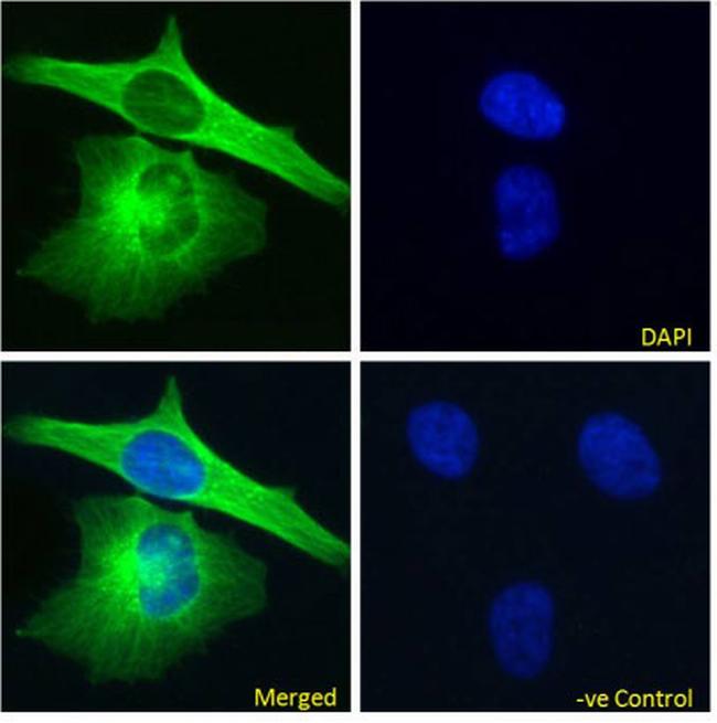 alpha Tubulin Chimeric Antibody in Immunocytochemistry (ICC/IF)