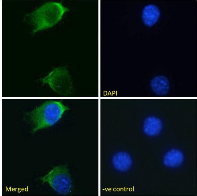 EGFR Chimeric Antibody in Immunocytochemistry (ICC/IF)