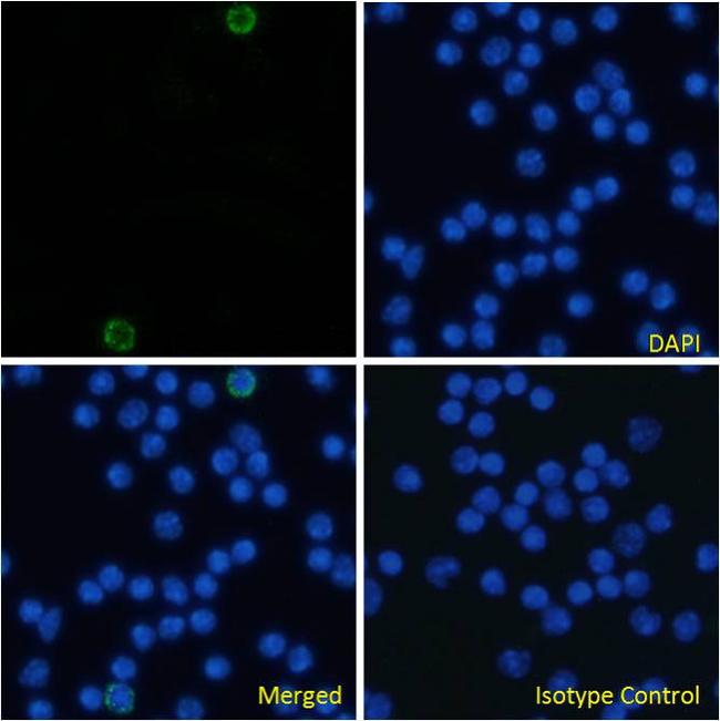 CD105 (Endoglin) Chimeric Antibody in Immunocytochemistry (ICC/IF)