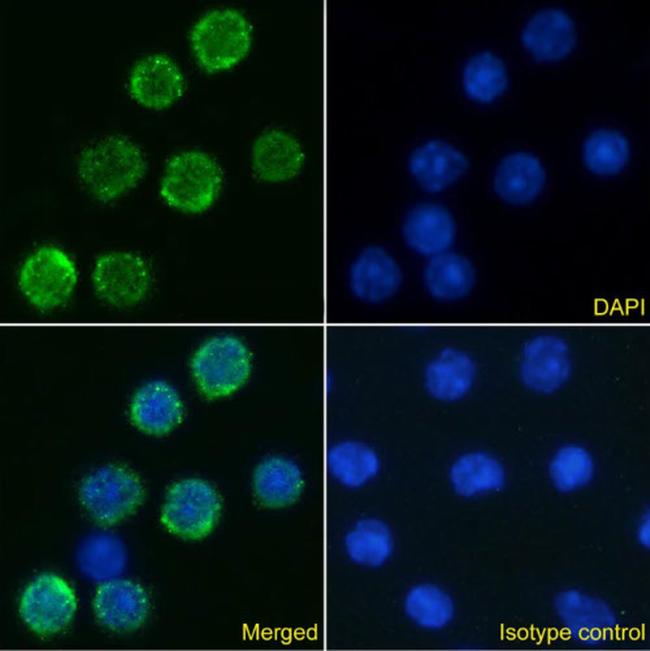 IL-6 Receptor (CD126) Chimeric Antibody in Immunocytochemistry (ICC/IF)