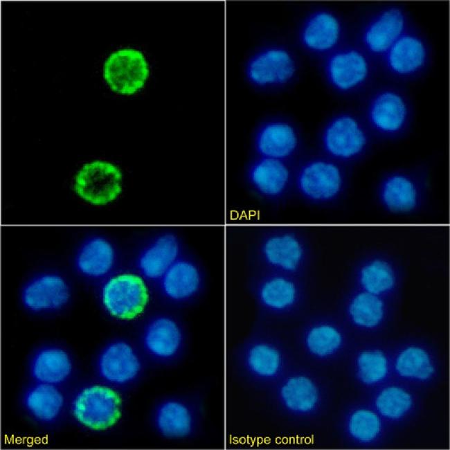 IL2RG Chimeric Antibody in Immunocytochemistry (ICC/IF)