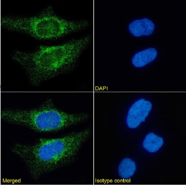 CD171 (L1CAM) Antibody in Immunocytochemistry (ICC/IF)