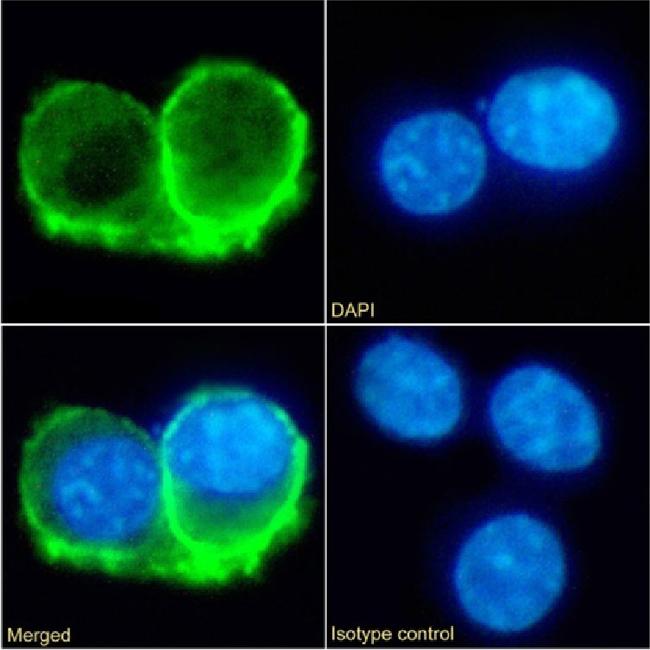 IL10RA Chimeric Antibody in Immunocytochemistry (ICC/IF)