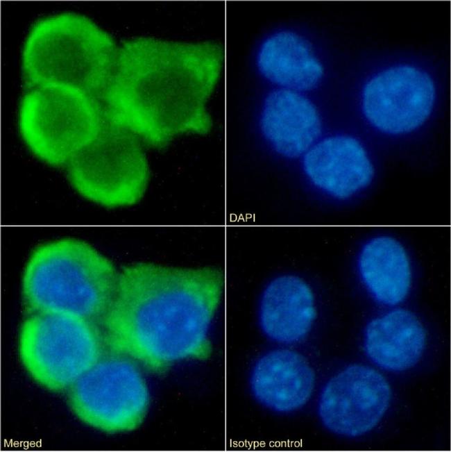 CCR7 Chimeric Antibody in Immunocytochemistry (ICC/IF)