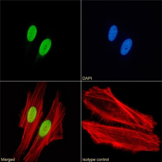 H4ac pan-acetyl (K8,K12,K16) Chimeric Antibody in Immunocytochemistry (ICC/IF)