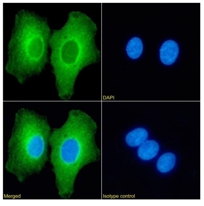 L3MBTL1 Chimeric Antibody in Immunocytochemistry (ICC/IF)