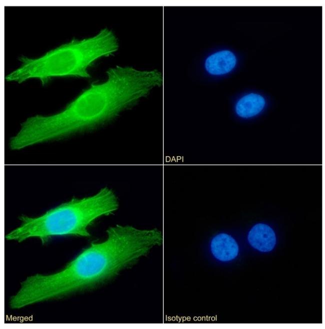 SETD7 Chimeric Antibody in Immunocytochemistry (ICC/IF)