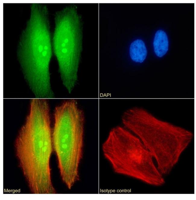 TDRD3 Chimeric Antibody in Immunocytochemistry (ICC/IF)