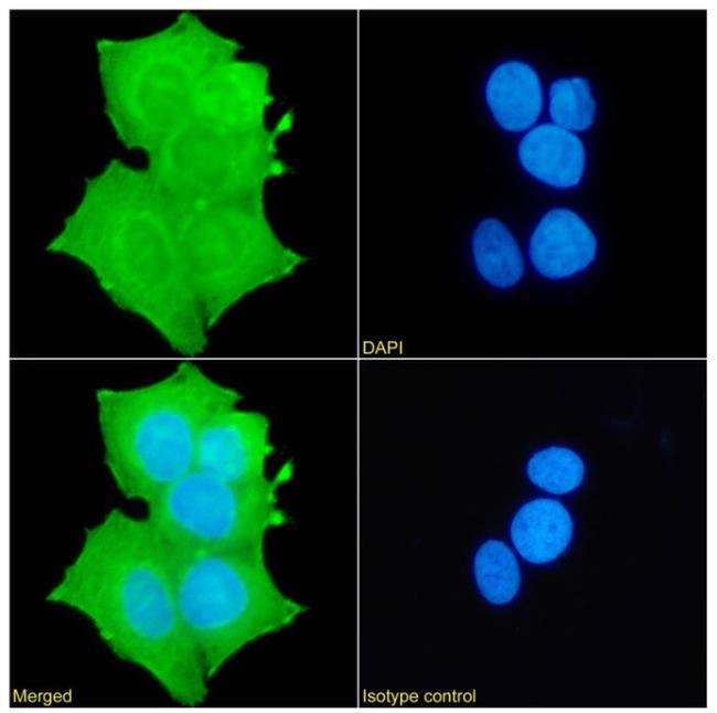 FOXP1 Chimeric Antibody in Immunocytochemistry (ICC/IF)