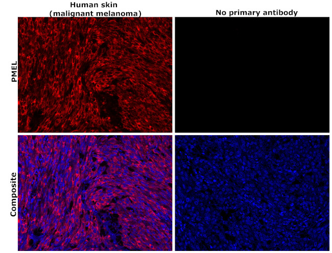 PMEL Antibody in Immunohistochemistry (Paraffin) (IHC (P))