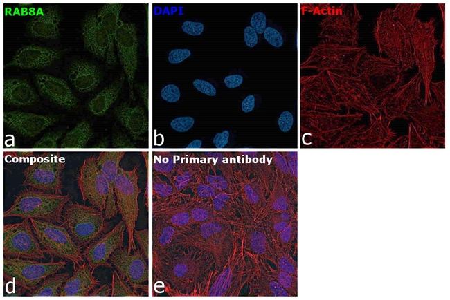 RAB8A Antibody in Immunocytochemistry (ICC/IF)