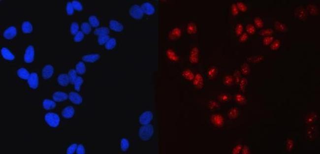 SP1 Antibody in Immunocytochemistry (ICC/IF)