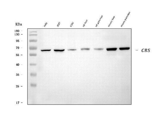 CBS Antibody in Western Blot (WB)