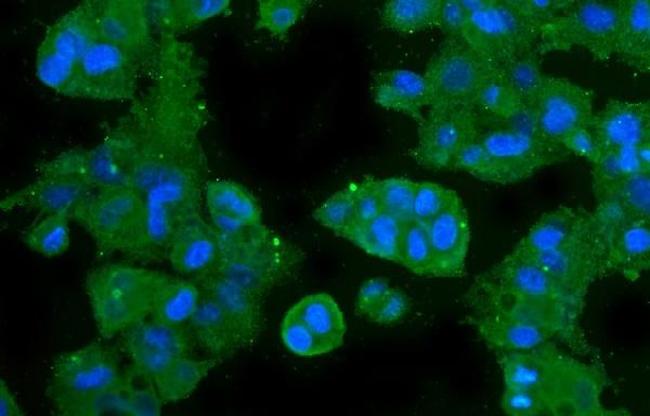 Carbonic Anhydrase II Antibody in Immunocytochemistry (ICC/IF)